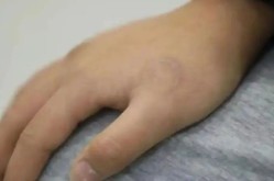 14岁少女瞒报年龄文身近6万元清洗费谁负责？法院判了公共场所卫生管理条例最新